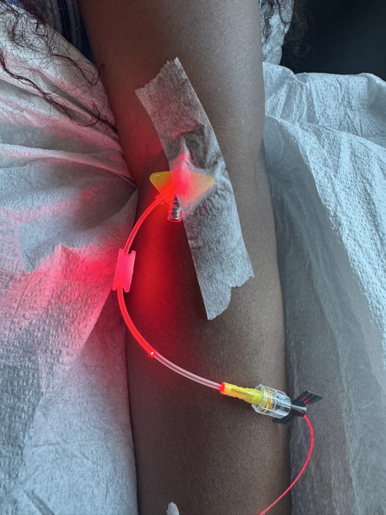 Red light visible along an intravenous line during a light-based treatment at LEMMO Cancer Care